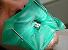 All About the Dental Dam