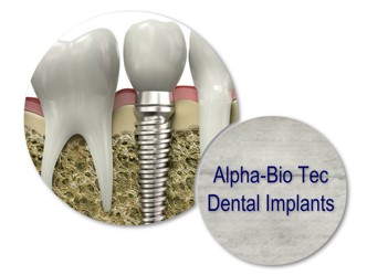 Alpha-Bio Tec Dental Implants in Romania