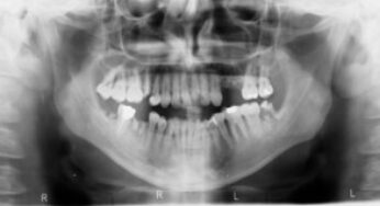 Dental Radiology in Romania