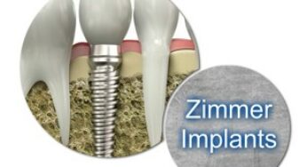 Zimmer Implants in Romania